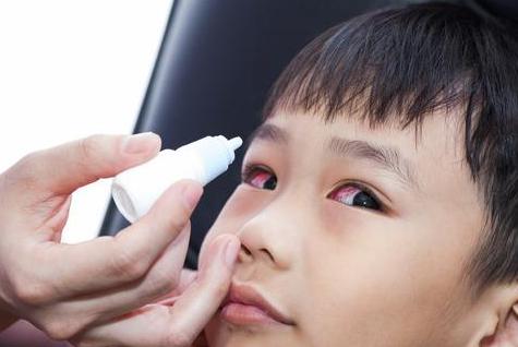 春季孩子红眼病传染太快?家长护理需注意以下几点