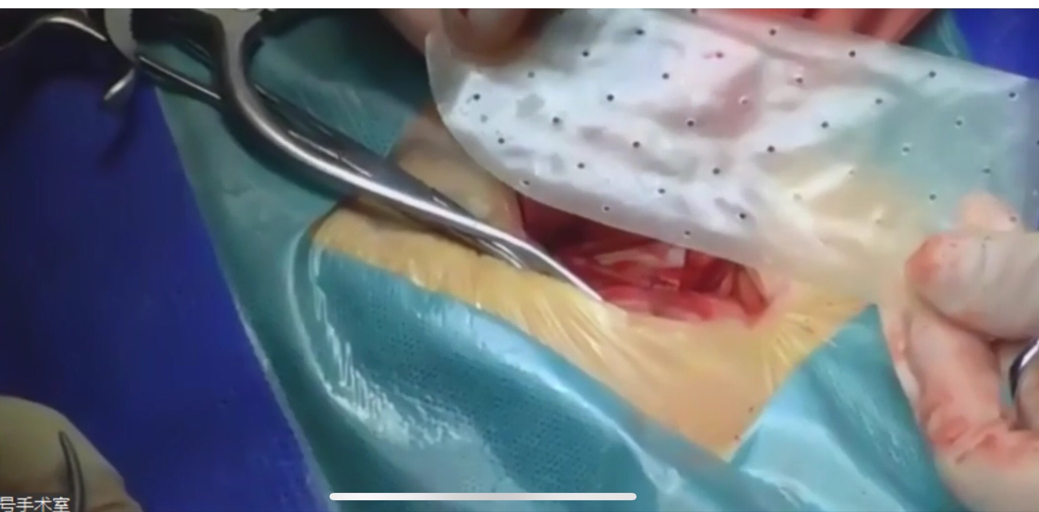 疝生物补片在亚太疝协会临床技能培训班上演1 1=1__凤凰网